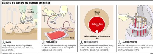 Procesamiento de Preservación de Células Madre del Cordón Umbilical