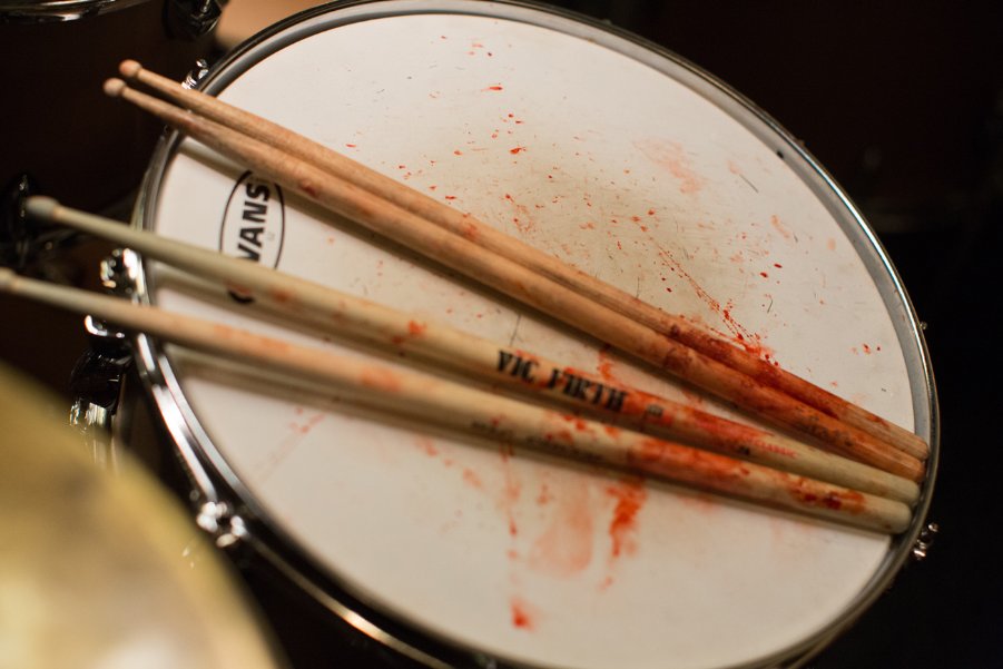 whiplash-3